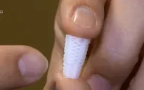 Tiết kiệm thời gian và chi phí điều trị bằng chân răng 3D