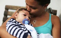 Virus zika gây chậm phát triển thần kinh ở trẻ