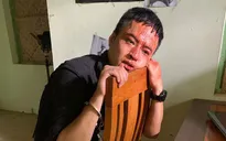 Hồng Đăng đầm đìa máu trong cảnh quay đóng máy "Mê cung"