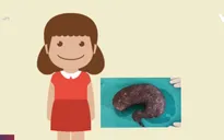 Bé gái 9 tuổi nhổ trụi tóc mình để ăn