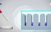 Ứng dụng công nghệ in 3D trong điều trị hói đầu