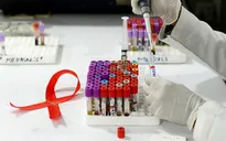 Tỷ lệ tử vong do HIV/AIDS trên thế giới có xu hướng giảm