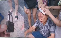 Cụ ông bị ổ khóa từ tầng cao chung cư rơi xuống làm chảy máu đầu