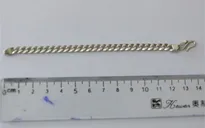 Đang chơi, bé trai nuốt sợi dây chuyền bạc dài 14cm