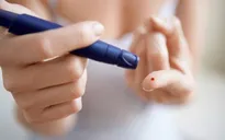 Kiểm soát lượng đường trong máu có thể kiềm chế ung thư tế bào vẩy
