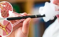Mỹ điều tra mối liên hệ giữa bệnh phổi và thuốc lá điện tử