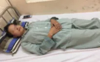Mỗi ngày hít vài quả bóng cười, thiếu nữ 18 tuổi nhập viện