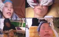 TP.HCM: Hàng ngàn cơ sở làm đẹp thực hiện kỹ thuật xâm lấn phi pháp
