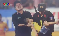Có nên cho trẻ cắn tay khi bị co giật?
