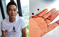 Hậu bị ám sát hụt, Nhậm Đạt Hoa vẫn phải đến bệnh viện mỗi ngày
