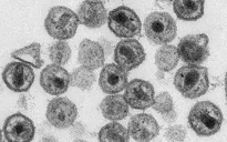 Trung Quốc chỉnh sửa gen chữa HIV, ung thư máu