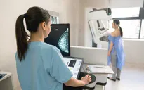 Khi nào nên tầm soát phát hiện sớm ung thư?