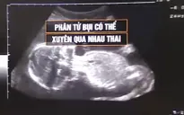 Phát hiện các phân tử ô nhiễm không khí trong bào thai