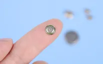 Bé trai 5 tuổi bị thủng màng nhĩ vì... nhét pin vào tai