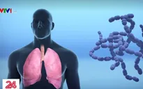 Dịch nCoV: Kết hợp thuốc điều trị HIV và cúm cho kết quả khả quan