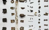 Khối dị vât kim loại hiếm gặp trong dạ dày bệnh nhân