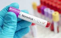 Hàng loạt sinh viên Trung Quốc nhiễm Norovirus