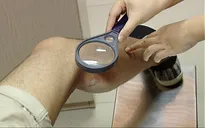 Gần 100 người đến khám mỗi ngày vì tiếp xúc với kiến ba khoang