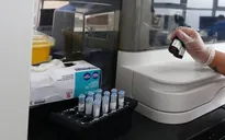 Chile truy xét sự tồn tại của một chủng virus corona lạ