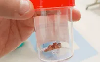 Lấy mảnh bông gòn dính trong... âm đạo bé gái suốt 1 tháng
