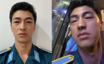 Bình An bất ngờ bị sưng húp mắt khi quay phim
