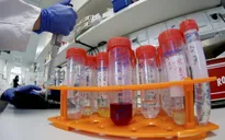 Du khách đến Singapore phải xét nghiệm PCR trong vòng 72 giờ trước khi khởi hành