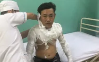 Thanh niên tẩm xăng cướp ngân hàng, tự thiêu khi bị truy bắt ở TP.HCM