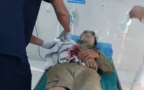 Thêm ca cấp cứu bị máy cưa gỗ cắt vào tay, bác sĩ cảnh báo cẩn trọng với tai nạn lao động