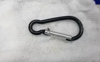 Gắp móc chìa khóa trong dạ dày bé 20 tháng tuổi