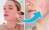 Tác hại khó lường khi sử dụng 7 sản phẩm chăm sóc da này sai cách