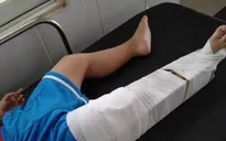Tạm đình chỉ cô giáo làm bé 3 tuổi gãy xương đùi trong lớp