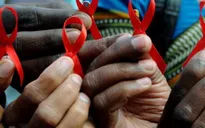 Dịch COVID-19 có nguy cơ làm gia tăng số ca nhiễm HIV/AIDS