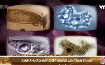 Mỹ : Amip ăn não gây chết người lan tràn qua hệ thống nước ngọt
