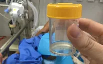 Không chủ quan với bệnh viêm màng não