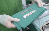 Hơn 5 tiếng phẫu thuật lấy lưỡi dao trong ổ bụng bệnh nhân