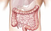 Rối loạn hoóc môn ruột điều hòa chất béo ở những người bị gan nhiễm mỡ