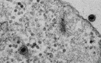 Phát hiện chủng virus mới có nguồn gốc amip