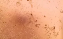 Châu Âu lần đầu nuôi cấy thành công chủng virus corona mới