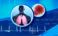 Phú Thọ bác thông tin có ca nhiễm nCoV
