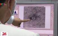 Phát hiện virus nCoV đơn lẻ ở môi trường bên ngoài