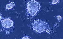 Thử nghiệm tế bào gốc iPS để chữa bệnh Parkinson