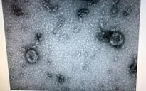 Việt Nam nuôi cấy và phân lập thành công virus Corona mới