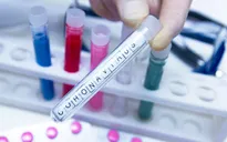 Vaccine phòng ngừa COVID-19 sắp được thử nghiệm tại Mỹ