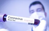 Có thêm 5 ca nhiễm COVID-19 mới tại TP.HCM
