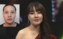 Change Life: Cô gái mặt lệch "lột xác" trở thành người mẫu thời trang