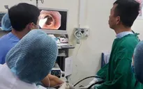 Lấy xương cá hình chữ T mắc kẹt trong thực quản người đàn ông