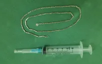 Lấy sợi dây chuyền dài gần 40 cm trong dạ dày của bé 2 tuổi
