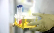 Nhật Bản phát triển vaccine ADN phòng chống virus SARS-CoV-2