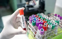 Nga phát triển 3 loại thuốc hỗ trợ điều trị COVID-19