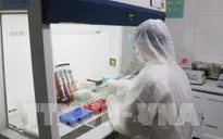 Bệnh viện Nhi Trung ương 2 được xét nghiệm virus COVID-19